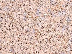 Invitrogen Phospho-BRCA1 (Ser1497) Polyclonal Antibody 100 μL; Unconjugated:Antibodies,