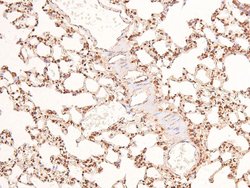 Invitrogen Phospho-BRCA1 (Ser1497) Polyclonal Antibody 100 μL; Unconjugated:Antibodies,