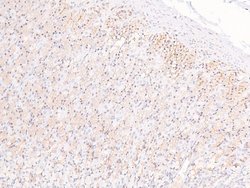 Invitrogen Phospho-eIF2b epsilon (Ser525) Polyclonal Antibody 100 &mu;L | Buy Online | Invitrogen&trade; | Fisher Scientific