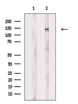 Invitrogen Phospho-PDGFRA (Tyr1018) Polyclonal Antibody 100 &mu;L | Buy Online | Invitrogen&trade; | Fisher Scientific