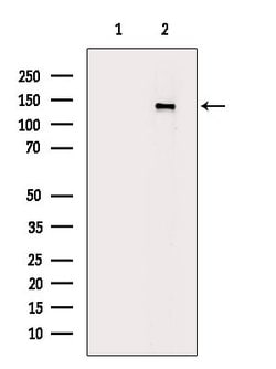 Invitrogen Phospho-PDGFRA (Tyr1018) Polyclonal Antibody 100 &mu;L | Buy Online | Invitrogen&trade; | Fisher Scientific