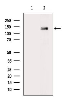 Invitrogen Phospho-PDGFRA (Tyr1018) Polyclonal Antibody 100 &mu;L | Buy Online | Invitrogen&trade; | Fisher Scientific