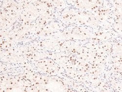 Invitrogen Phospho-53BP1 (Ser29) Polyclonal Antibody 100 &mu;L; Unconjugated:Antibodies,