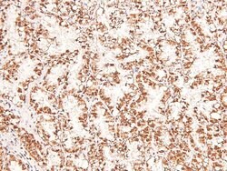 Phospho-BCLAF1 (Ser531) Polyclonal Antibody, Invitrogen 100 &mu;L; Unconjugated:Antibodies,
