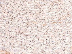 Phospho-BCLAF1 (Ser531) Polyclonal Antibody, Invitrogen 100 &mu;L; Unconjugated:Antibodies,