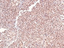 Invitrogen Phospho-CUX1 (Ser1215) Polyclonal Antibody 100 &mu;L; Unconjugated:Antibodies,
