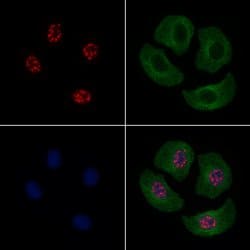 Invitrogen Phospho-JDP2 (Thr148) Polyclonal Antibody 100 &mu;L; Unconjugated:Antibodies,