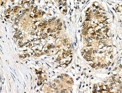 Invitrogen Phospho-JDP2 (Thr148) Polyclonal Antibody 100 &mu;L; Unconjugated:Antibodies,