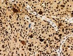 Invitrogen Phospho-JDP2 (Thr148) Polyclonal Antibody 100 &mu;L; Unconjugated:Antibodies,