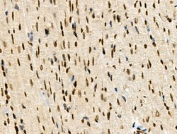 Invitrogen Phospho-MUC1 (Ser1227) Polyclonal Antibody 100 &mu;L; Unconjugated:Antibodies,