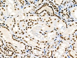 Invitrogen Phospho-MUC1 (Ser1227) Polyclonal Antibody 100 &mu;L; Unconjugated:Antibodies,
