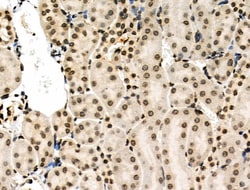Invitrogen Phospho-MUC1 (Ser1227) Polyclonal Antibody 100 &mu;L; Unconjugated:Antibodies,
