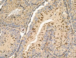 Invitrogen Phospho-NACA (Ser43) Polyclonal Antibody 100 &mu;L; Unconjugated:Antibodies,