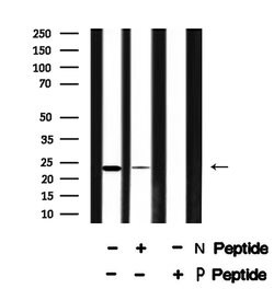 Invitrogen Phospho-NACA (Ser43) Polyclonal Antibody 100 &mu;L; Unconjugated:Antibodies,