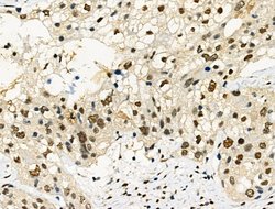 Invitrogen Phospho-PDX1 (Ser61) Polyclonal Antibody 100 &mu;L; Unconjugated:Antibodies,