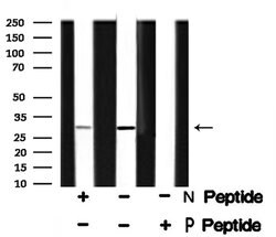 Invitrogen Phospho-PDX1 (Ser61) Polyclonal Antibody 100 &mu;L; Unconjugated:Antibodies,