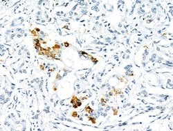 Invitrogen Phospho-PDX1 (Ser66) Polyclonal Antibody 100 &mu;L; Unconjugated:Antibodies,