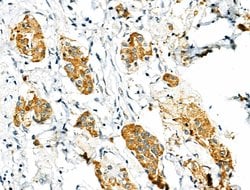 Invitrogen Phospho-PDX1 (Ser66) Polyclonal Antibody 100 &mu;L; Unconjugated:Antibodies,
