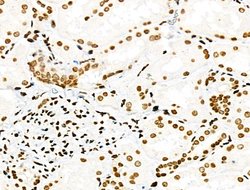 Invitrogen Phospho-PDX1 (Ser66) Polyclonal Antibody 100 &mu;L; Unconjugated:Antibodies,