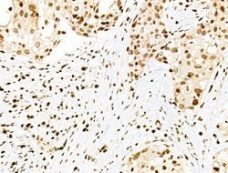 Invitrogen Phospho-PDX1 (Ser66) Polyclonal Antibody 100 &mu;L; Unconjugated:Antibodies,