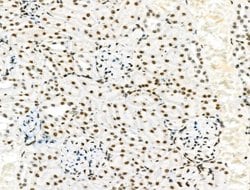 Invitrogen Phospho-PDX1 (Ser66) Polyclonal Antibody 100 &mu;L; Unconjugated:Antibodies,