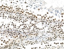 Invitrogen Phospho-PDX1 (Ser66) Polyclonal Antibody 100 &mu;L; Unconjugated:Antibodies,