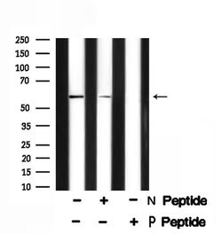 Invitrogen Phospho-Presenilin 1 (Ser353) Polyclonal Antibody 100 &mu;L;