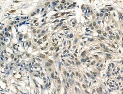 Invitrogen Phospho-RAD50 (Ser635) Polyclonal Antibody 100 &mu;L | Buy Online | Invitrogen&trade; | Fisher Scientific