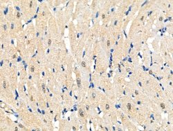 Invitrogen Phospho-RAD50 (Ser635) Polyclonal Antibody 100 &mu;L | Buy Online | Invitrogen&trade; | Fisher Scientific