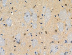 Invitrogen Phospho-RAD50 (Ser635) Polyclonal Antibody 100 &mu;L | Buy Online | Invitrogen&trade; | Fisher Scientific