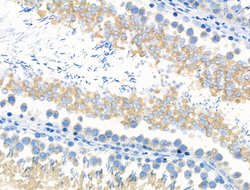 Invitrogen Phospho-SGOL1 (Ser14) Polyclonal Antibody 100 &mu;L | Buy Online | Invitrogen&trade; | Fisher Scientific