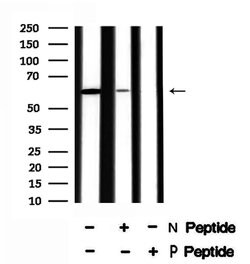 Invitrogen Phospho-SGOL1 (Ser14) Polyclonal Antibody 100 &mu;L | Buy Online | Invitrogen&trade; | Fisher Scientific