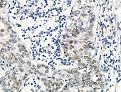 Invitrogen Phospho-SRF (Thr159) Polyclonal Antibody 100 &mu;L; Unconjugated:Antibodies,