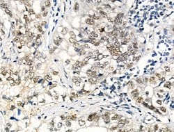 Invitrogen Phospho-SRF (Thr159) Polyclonal Antibody 100 &mu;L; Unconjugated:Antibodies,