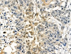 Invitrogen Phospho-SRF (Thr159) Polyclonal Antibody 100 &mu;L; Unconjugated:Antibodies,