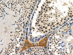 Invitrogen Phospho-SRF (Thr159) Polyclonal Antibody 100 &mu;L; Unconjugated:Antibodies,