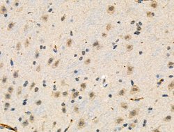 Invitrogen Phospho-TAB1 (Ser438) Polyclonal Antibody 100 &mu;L; Unconjugated:Antibodies,