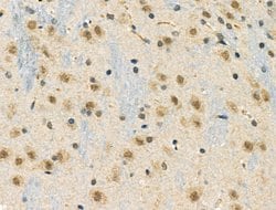 Invitrogen Phospho-TAB1 (Ser438) Polyclonal Antibody 100 &mu;L; Unconjugated:Antibodies,