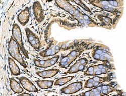 Invitrogen Phospho-TAB1 (Ser438) Polyclonal Antibody 100 &mu;L; Unconjugated:Antibodies,