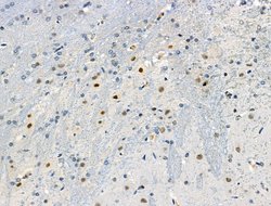 Invitrogen Phospho-ETV6 (Ser257) Polyclonal Antibody 100 &mu;L; Unconjugated:Antibodies,