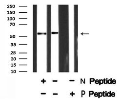 Invitrogen Phospho-ETV6 (Ser257) Polyclonal Antibody 100 &mu;L; Unconjugated:Antibodies,