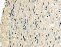 Invitrogen Phospho-XRCC4 (Ser260) Polyclonal Antibody 100 &mu;L; Unconjugated:Antibodies,