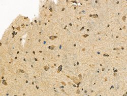 Invitrogen Phospho-XRCC4 (Ser260) Polyclonal Antibody 100 &mu;L; Unconjugated:Antibodies,