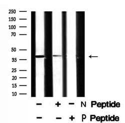 Invitrogen Phospho-XRCC4 (Ser260) Polyclonal Antibody 100 &mu;L; Unconjugated:Antibodies,