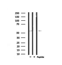 Invitrogen Phospho-DOK2 (Tyr345) Polyclonal Antibody 100 &mu;L; Unconjugated:Antibodies,