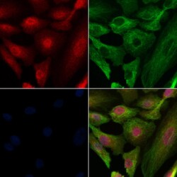 Invitrogen Phospho-PRK1/PRK2 (Thr774, Thr816) Polyclonal Antibody 100 &mu;L | Buy Online | Invitrogen&trade; | Fisher Scientific