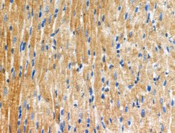 Invitrogen Phospho-PRK1/PRK2 (Thr774, Thr816) Polyclonal Antibody 100 &mu;L | Buy Online | Invitrogen&trade; | Fisher Scientific