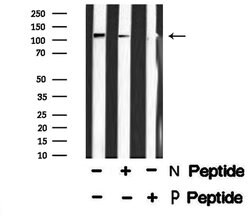 Invitrogen Phospho-PRK1/PRK2 (Thr774, Thr816) Polyclonal Antibody 100 &mu;L | Buy Online | Invitrogen&trade; | Fisher Scientific