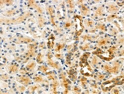 Invitrogen Phospho-Caspase 3 (Ser26) Polyclonal Antibody 100 &mu;L; Unconjugated:Antibodies,