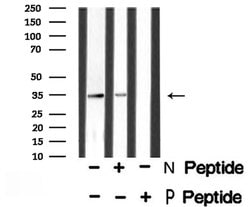 Invitrogen Phospho-Caspase 3 (Ser26) Polyclonal Antibody 100 &mu;L; Unconjugated:Antibodies,